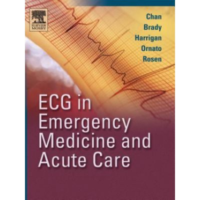 ECG in Emergency Medicine and Acute Care