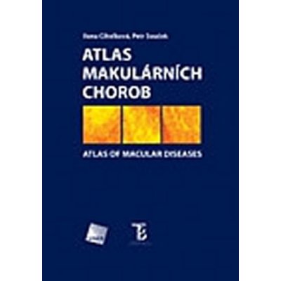 Atlas makulárních chorob