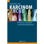 Karcinom jícnu – Zboží Mobilmania