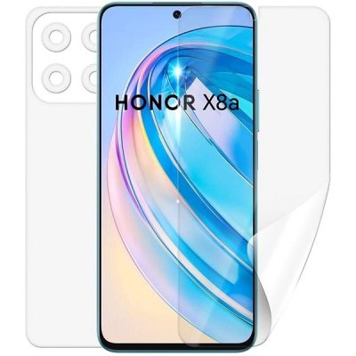 Ochranná fólie ScreenShield HONOR X8a - celé tělo