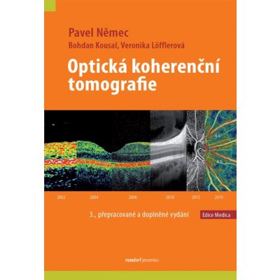Optická koherenční tomografie - Němec Pavel, Löfflerová Veronika, Kousal Bohdan
