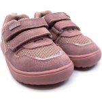 Protetika Alex nude – Zbozi.Blesk.cz