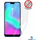 Ochranná fólie Screenshield Huawei Honor 10 - displej