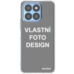 Picasee silikonové Honor X8b - Vlastní design/motiv průhledné – Zboží Živě