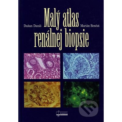 Malý atlas renálnej biopsie - Dušan Daniš, Marián Benčat – Hledejceny.cz