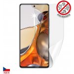 Ochranná fólie Screenshield XIAOMI 11T Pro - displej – Sleviste.cz