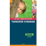 Turnerův syndrom – Hledejceny.cz