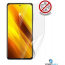 Ochranná fólie Screenshield Xiaomi POCO X3 - displej