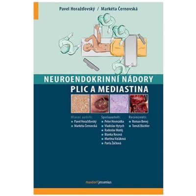 Neuroendokrinní nádory plic a mediastina - Pavel Horažďovský, Markéta Černovská – Zbozi.Blesk.cz