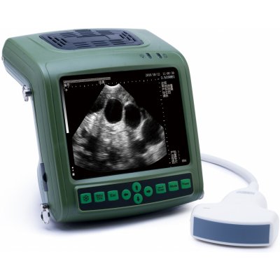 Ultrazvukový skener ES8 s konvexní sondou – Sleviste.cz