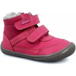 Protetika Tyrel Koral – Zboží Dáma