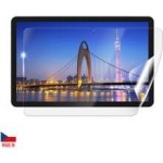 Screenshield IGET Smart L11 2K fólie na displej IGT-SML112K-D – Zbozi.Blesk.cz