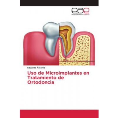 Uso de Microimplantes en Tratamiento de Ortodoncia – Zboží Mobilmania