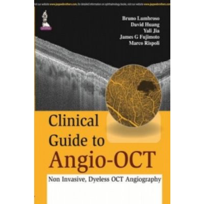 Clinical Guide to Angio-OCT: Non Invasive, Dyeless OCT Angiography - Lumbroso BrunoPevná vazba