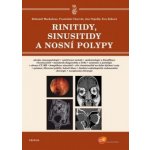 Rinitidy, sinusitidy a nosní polypy – Hledejceny.cz