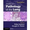 Kniha Spencer's Pathology of the Lung 2 Part Set