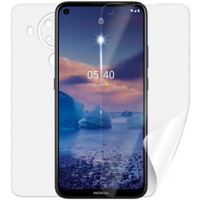 Ochranná fólie Screenshield NOKIA 5.4 (2020) - celé tělo – Zboží Mobilmania