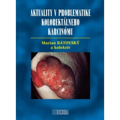 Aktuality v problematike kolorektálneho karcinómu – Hledejceny.cz