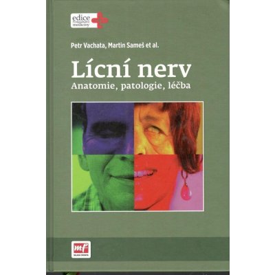 Mladá fronta a. s. Lícní nerv - Anatomie, patologie, léčba – Zbozi.Blesk.cz