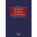 Mozkové ischemie a hemoragie – Hledejceny.cz