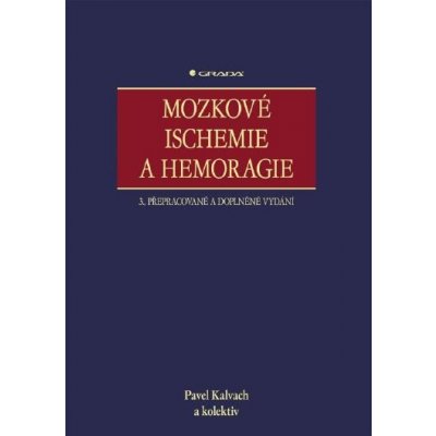 Mozkové ischemie a hemoragie – Hledejceny.cz