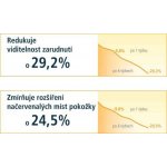 Coupeliac zklidňující denní krém SPF15 50 ml – Zboží Dáma