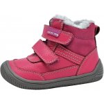 Protetika Tyrel Koral – Zboží Dáma