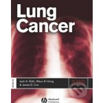 Lung Cancer - Jack A. Roth, James D. Cox, Waun Ki Hong – Hledejceny.cz