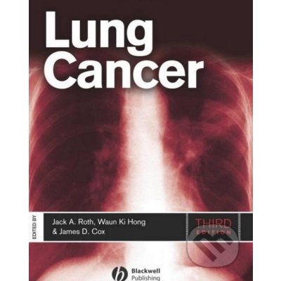 Lung Cancer - Jack A. Roth, James D. Cox, Waun Ki Hong – Hledejceny.cz