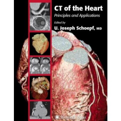 CT of the Heart