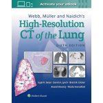 Webb, Muller and Naidich's High-Resolution CT of the Lung – Hledejceny.cz