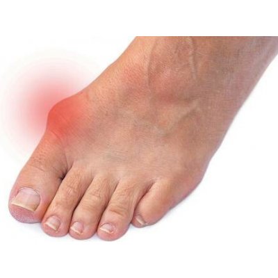 VV Design Komfort Hallux Valgus – Hledejceny.cz