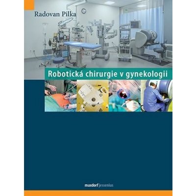 Robotická chirurgie v gynekologii – Hledejceny.cz