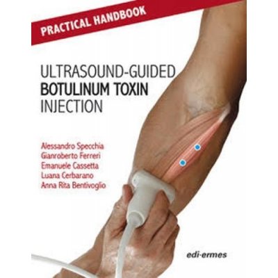 Practical Handbook for Ultrasound-guided Botulinum Toxin Injection – Zbozi.Blesk.cz