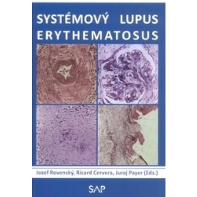 Systémový lupus erythematosus