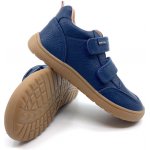 Protetika Alan Navy – Sleviste.cz