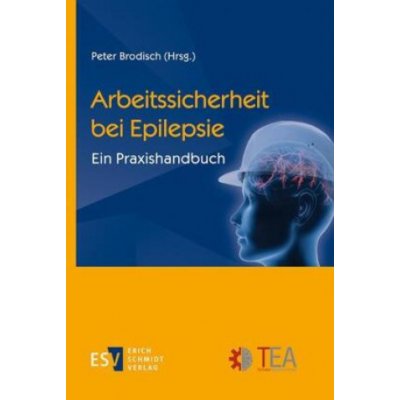 Arbeitssicherheit bei Epilepsie – Zbozi.Blesk.cz