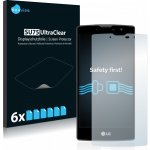 6x SU75 UltraClear Screen Protector LG Magna – Hledejceny.cz