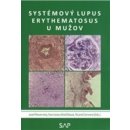 Systemovy lupus erythematosus u muzov - Jozef Rovenský, Stanislava Blažičková