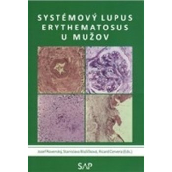 Systemovy lupus erythematosus u muzov - Jozef Rovenský, Stanislava Blažičková
