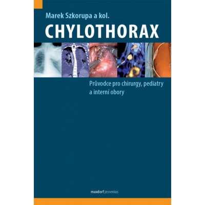 Chylothorax - Průvodce pro chirurgy, pediatry a interní obory - Szkorupa Marek – Zbozi.Blesk.cz