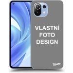 Pouzdro Picasee silikonové Xiaomi Mi 11 Lite - Vlastní design/motiv černé – Zbozi.Blesk.cz