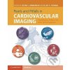 Kniha Pearls and Pitfalls in Cardiovascular Imaging - Cambridge University Press