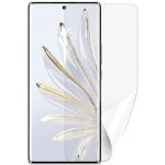 Ochranná fólie Screenshield HONOR 70- displej – Sleviste.cz