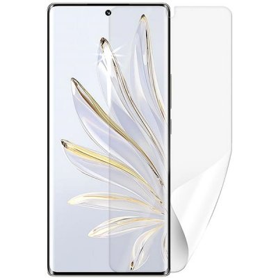 Ochranná fólie Screenshield HONOR 70- displej – Hledejceny.cz