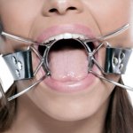 Fetish Fantasy Extreme Spider Gag ocelový roubík rozevírač úst – Zboží Dáma