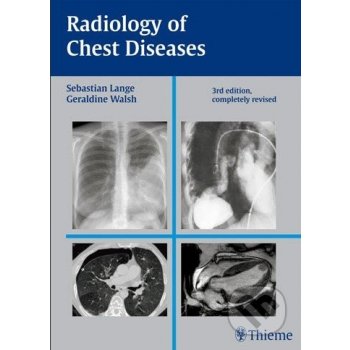 Radiology of Chest Diseases - Sebastian Lange