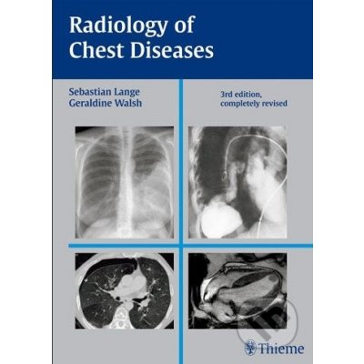 Radiology of Chest Diseases - Sebastian Lange – Hledejceny.cz