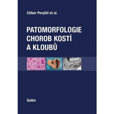 Patomorfologie chorob kostí a kloubů – Zbozi.Blesk.cz
