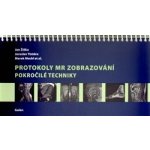 Protokoly MR zobrazování. Pokročilé techniky - Jan Žižka, Jaroslav Tintěra – Hledejceny.cz